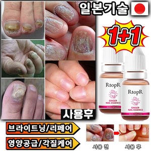 [당일 배송] 1+1/2+2 발톱 무좀 앰플 네일 리페어 발톱 강화 발톱 영양제 문제성 발톱 케어 효과보장, 2개, 10ml