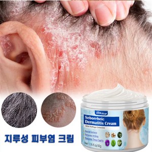 (국내배송) 지루성두피 비듬 각질 가려움, 1개, 50ml