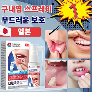 구내염 스프레이 구내염 구내염약 잇몸구내염 잇몸염증 구강상처 구강청결제, 1개, 30ml