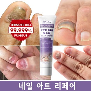 HANLU [빠른배송] 발톱진균 리페어 연고 발톱진균제 갑진균병 살균, 2개, 20g