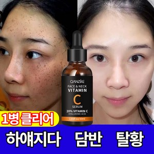 트라넥삼산 카바메이트 에센스 화이트닝 기미제거 시간 흔적제거, 3개, 30ml