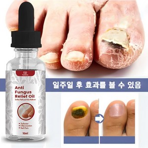 발톱 무좀 케어 손톱진균 발톱무좀 큐티클 트리트먼트 에센스, 10ml, 1개, 1개입