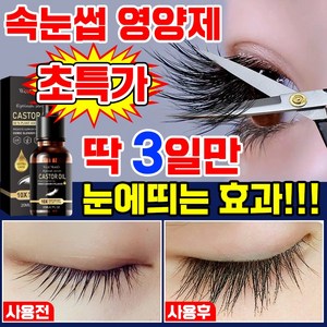 [효과보장] 1/1+1/2+2 속눈썹 영양제 아이래쉬 세럼 셀프 눈썹 연장 에센스 블랙 속눈썹 강화 리페어 무자극, 1개, 20ml