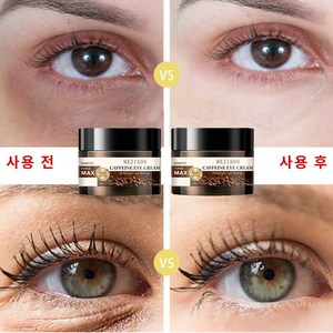 눈밑지방재배치 비 지방 육아종 제거 크림 주름과 다크 서클을위한 아이 크림 콜라겐 눈밑지방, 2개, 50ml