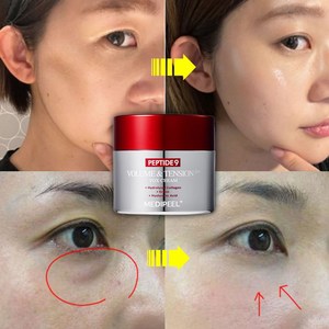 안면 리프팅 주름 크림 이미 눈 밑 꺼짐 팔자 탄력 부여 리프팅 케어 물광 볼륨 영양 광채 볼륨 크림, 1개