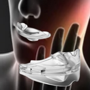 메디슬립 이갈이 차단 습관 방지 기구 효과보장형 턱관절 보호 치료 교정기 반영구적, 1개