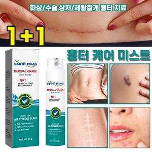 [피부과 전용] 흉터 제거 연고 흉터 케어 미스트 화상 물집 제왕절개흉터 수술흉터 연고 재생크림 여드름흉터 제거 스프레이, 2개, 20ml