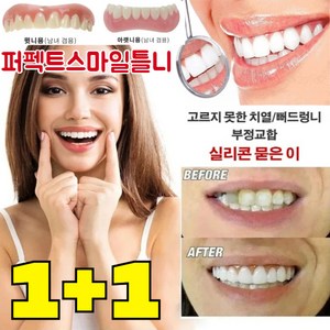 [국내배송] 1+1 퍼펙트스마일틀니 임시 틀니 재사용 가능/눈에 띄지 않음/간단히 탈부착, 상하 세트*1+1, 2개