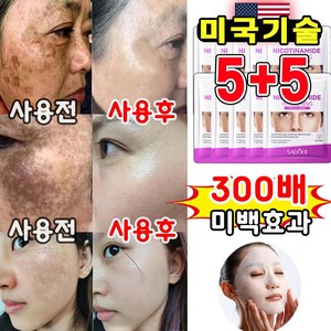 미국기술 얼굴 기미 미백 마스크팩 비타민 화이트닝 브라이트닝 기미 제거 색소침착 미백 앰플 다이아몬드 데일리 마스크팩 사은품 랜덤 증정, 1개, 10개입