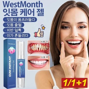 1/1+1 WestMonth 잇몸케어 젤 잇몸 부기구강 케어 잇몸질환예방, 2개, (4 + 4)