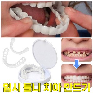 [국내배송] 임시 틀니 치아 이빨 셀프 만들기 재료 보관함, 상하세트, 1개