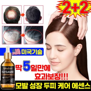 [효과보장] 1/1+1/2+2 머리 성장 에센스 두피케어 세럼 방지 완화 영양 에센스, 4개, 30ml