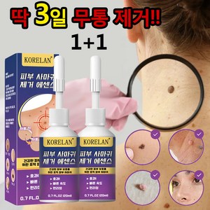 [HPV바이러스/본토출하] 문제를 해결하는 편평사마귀 율무 얼굴사마귀 사상사마귀 피부치료 비립종제거제, 2개, 20ml