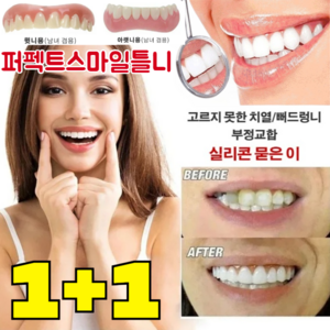 [국내배송] 1+1 임시 틀니 가짜이빨 임시치아 재사용 가능, 2개, 상하