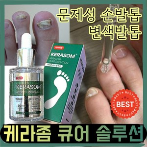 [정품] 문제성 발톱 손톱 케어 I케I라I좀I 큐어 솔루션 손톱영양제 발톱영양제, 1세트, 30ml