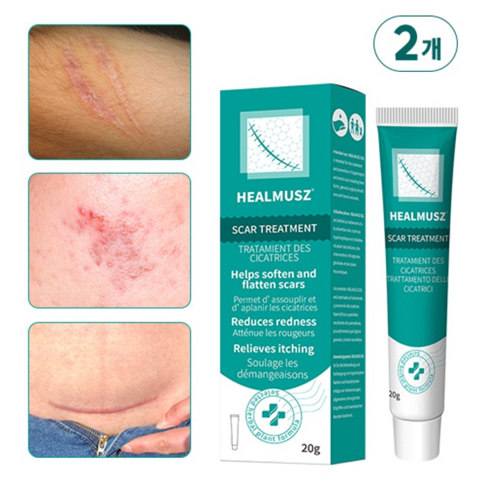 HEALMUSZ 흉터제거연고 피부흉터 수술흉터 제거 화상 상처 흉터 흉터재생 관리 겔, 2개, 20ml HEALMUSZ 흉터제거연고 피부흉터 수술흉터 제거 화상 상처 흉터 흉터재생 관리 겔, 2개, 20ml