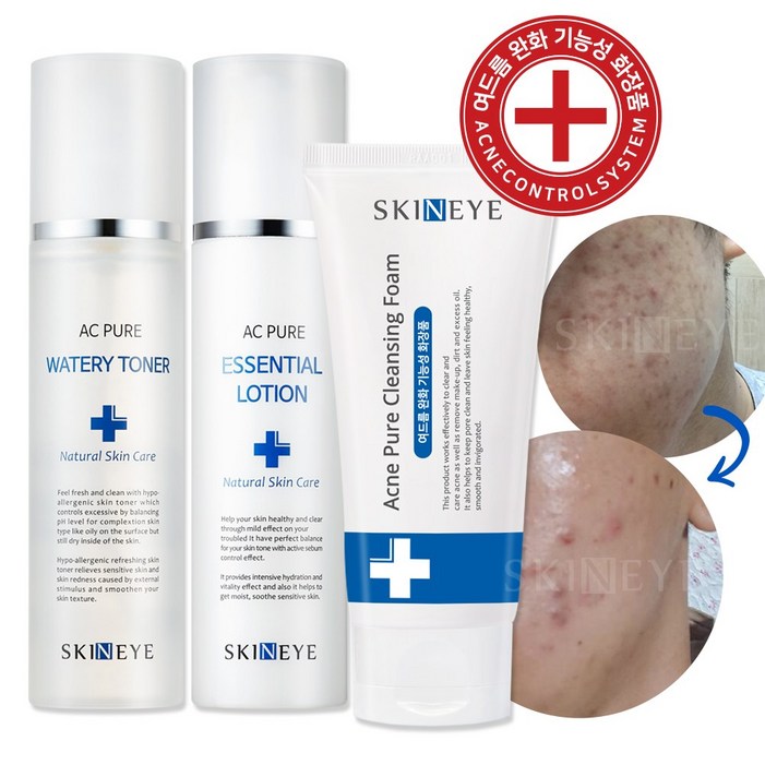 스킨아이 AC 퓨어 워터리 토너  에센셜 로션 아크네 청소년 여드름 클렌징 폼 SET 여드름 기초 스킨케어 3종 SET