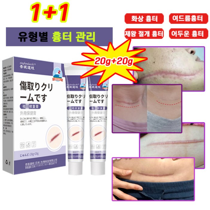 [100%제거/당일배송] 흉터제거 상처흉터 여드름 민감한 피부를 수술 화상 제왕절개 수술흉터
