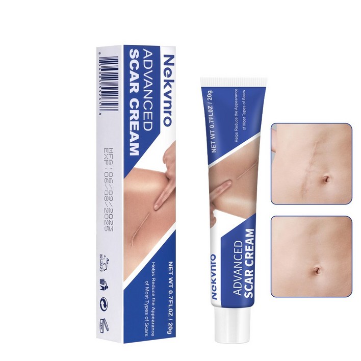 Nekvnro 복구 오래된 색소침착 제왕절개 켈로이드, 20ml, 2개