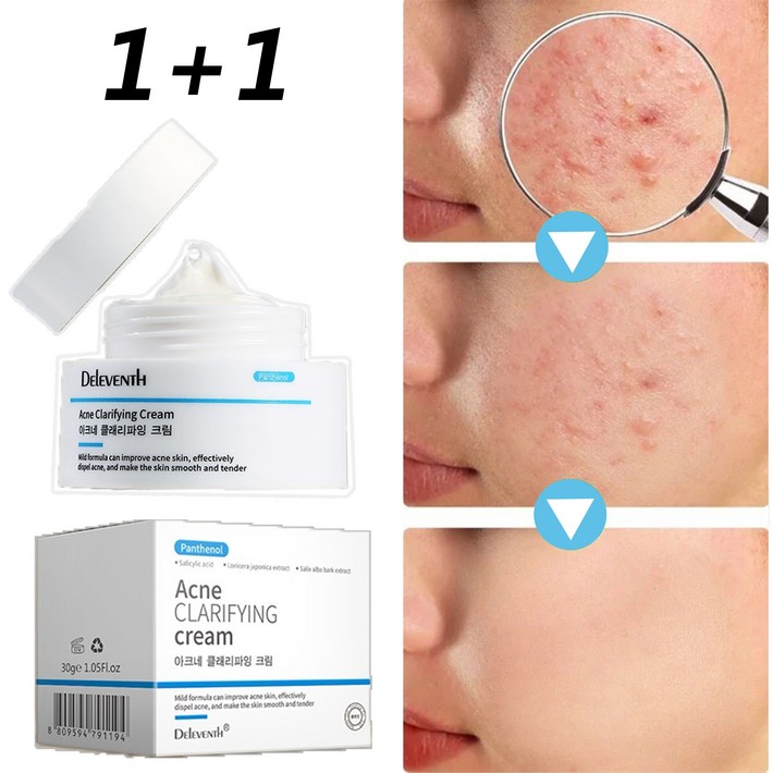 [제거효과 MAX]여드름 크림 천연 식물 성분 리페어 크림 민감피부 개선