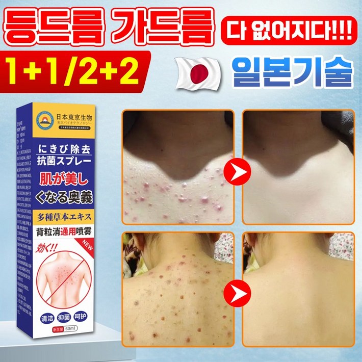 일본기술 11122 등드름 여드름 개선 진드기 미스트 가슴 피부관리 등 바디 트러블 스프레이 스킨케어 항균 청결 유수분밸런스
