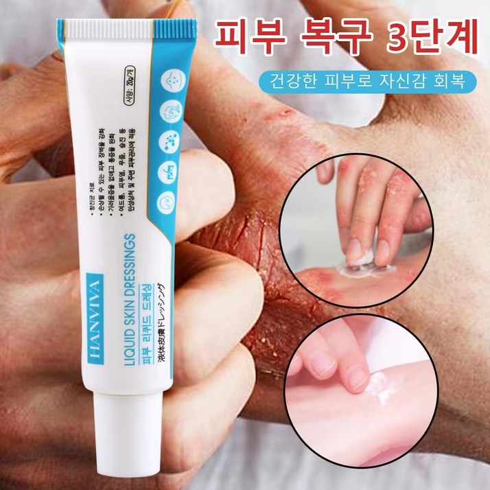 국내배송 피부 건선 피부 가려움증 여드름 습진 두드러기 발진 허브 연고 피부염 에좋은연고 피부 케어 보습 크림 국내배송 피부 건선 피부 가려움증 여드름 습진 두드러기 발진 허브 연고 피부염 에좋은연고 피부 케어 보습 크림