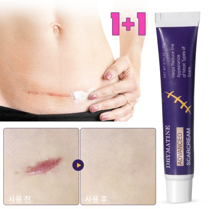 당일배송 DRYMATINE 흉터연고 흉터제거연고 재생크림 상처흉터연고 여드름흉터 수술흉터 화상물집 흉터제거연고 20g 당일배송 DRYMATINE 흉터연고 흉터제거연고 재생크림 상처흉터연고 여드름흉터 수술흉터 화상물집 흉터제거연고 20g