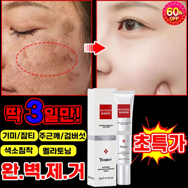 [피부과 전용] 2+2/1+1/1 기미크림 기미 잡티 주근깨 검버섯 제거 크림 멜라토닝 멜라논 크림 들깨기미크림 얼굴 색소침착 착색 화이트닝 포장증정
